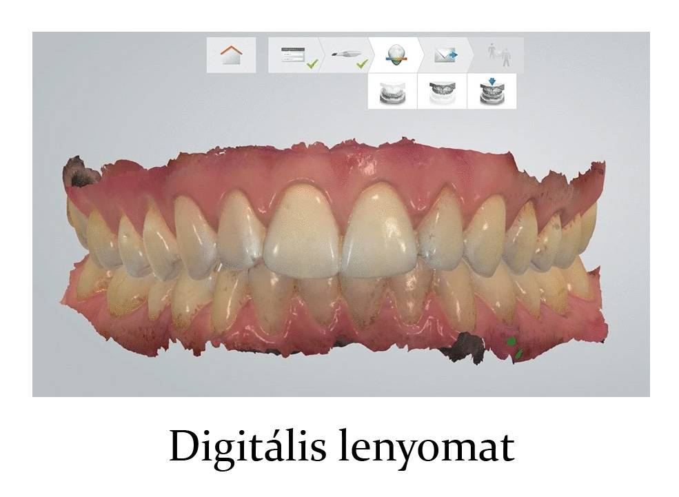Digitális lenyomat a monitoron