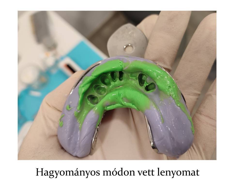Hagyományos vs. digitális lenyomat